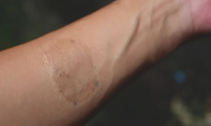 Boss Sees Scar on His Cleaning Lady and Tearfully Throws Himself into Her Arms